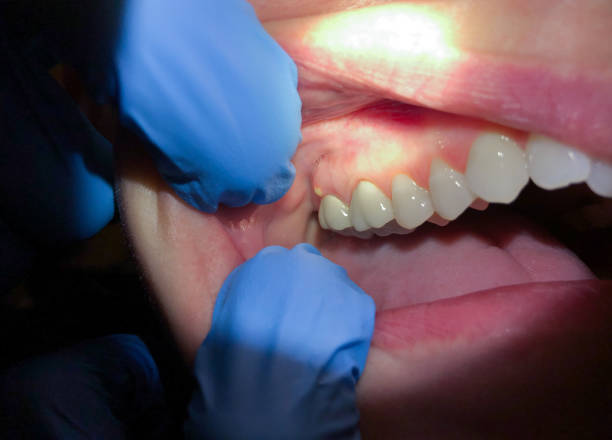 Best Emergency Dentist for Special Needs Patients in Beggs, OK