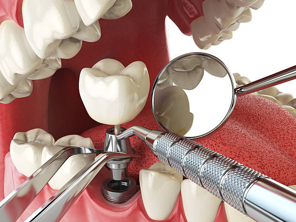 Best Broken or Cracked Tooth Emergency Dentist in Beggs, OK